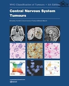 Central Nervous System Tumours (WHO Classification of Tumours) 5th Edición | طبقه بندی WHO از تومورهای سیستم عصبی مرکزی